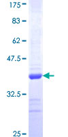 COL14A1 / Collagen XIV Protein - 12.5% SDS-PAGE Stained with Coomassie Blue.