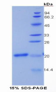 COL15A1 / Collagen XV Alpha 1 Protein - Recombinant Collagen Type XV By SDS-PAGE