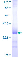 COL16A1 Protein - 12.5% SDS-PAGE Stained with Coomassie Blue.