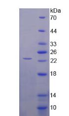 COL16A1 Protein - Recombinant  Collagen Type XVI By SDS-PAGE