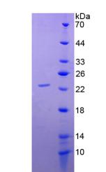 COL17A1 / Collagen XVII Protein - Recombinant Collagen Type XVII By SDS-PAGE
