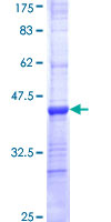 COL19A1 / Collagen XIX Protein - 12.5% SDS-PAGE Stained with Coomassie Blue.