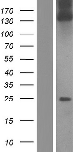 COL1A1 / Collagen I Alpha 1 Protein - Western validation with an anti-DDK antibody * L: Control HEK293 lysate R: Over-expression lysate