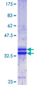 COL1A1 / Collagen I Alpha 1 Protein - 12.5% SDS-PAGE Stained with Coomassie Blue.