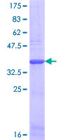 COL1A2 / Collagen I Alpha 2 Protein - 12.5% SDS-PAGE Stained with Coomassie Blue.