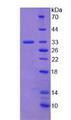 COL1A2 / Collagen I Alpha 2 Protein - Recombinant Collagen Type I Alpha 2 By SDS-PAGE