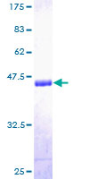 COL20A1 / Collagen XX Protein - 12.5% SDS-PAGE of human KIAA1510 stained with Coomassie Blue