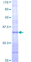 COL21A1 / Collagen XXI Protein - 12.5% SDS-PAGE Stained with Coomassie Blue.