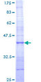 COL21A1 / Collagen XXI Protein - 12.5% SDS-PAGE Stained with Coomassie Blue.