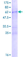 COL23A1 / Collagen XXIII Protein - 12.5% SDS-PAGE of human COL23A1 stained with Coomassie Blue