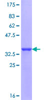 COL23A1 / Collagen XXIII Protein - 12.5% SDS-PAGE Stained with Coomassie Blue.