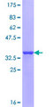 COL23A1 / Collagen XXIII Protein - 12.5% SDS-PAGE Stained with Coomassie Blue.