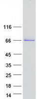 COL23A1 / Collagen XXIII Protein - Purified recombinant protein COL23A1 was analyzed by SDS-PAGE gel and Coomassie Blue Staining