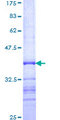 COL24A1 Protein - 12.5% SDS-PAGE Stained with Coomassie Blue.