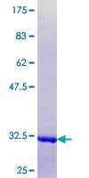 COL25A1 / Collagen XXV Protein - 12.5% SDS-PAGE Stained with Coomassie Blue.