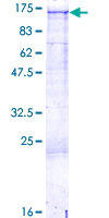 COL3A1 / Collagen III Protein - 12.5% SDS-PAGE of human COL3A1 stained with Coomassie Blue
