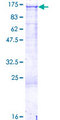 COL3A1 / Collagen III Protein - 12.5% SDS-PAGE of human COL3A1 stained with Coomassie Blue