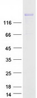 COL3A1 / Collagen III Protein - Purified recombinant protein COL3A1 was analyzed by SDS-PAGE gel and Coomassie Blue Staining