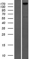 COL4A2 / Collagen IV Alpha2 Protein - Western validation with an anti-DDK antibody * L: Control HEK293 lysate R: Over-expression lysate