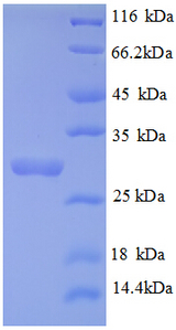 COL4A3 / Tumstatin Protein