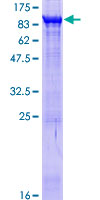 COL4A3BP / CERT Protein - 12.5% SDS-PAGE of human COL4A3BP stained with Coomassie Blue