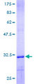 COL4A6 / Collagen IV Protein - 12.5% SDS-PAGE of human COL4A6 stained with Coomassie Blue