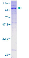 COL5A1 / Collagen V Alpha 1 Protein - 12.5% SDS-PAGE of human COL5A1 stained with Coomassie Blue