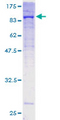 COL5A1 / Collagen V Alpha 1 Protein - 12.5% SDS-PAGE of human COL5A1 stained with Coomassie Blue