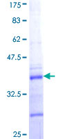 COL5A2 / Collagen V Alpha 2 Protein - 12.5% SDS-PAGE Stained with Coomassie Blue.