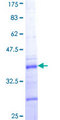 COL5A2 / Collagen V Alpha 2 Protein - 12.5% SDS-PAGE Stained with Coomassie Blue.