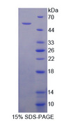 COL5A2 / Collagen V Alpha 2 Protein - Recombinant  Collagen Type V Alpha 2 By SDS-PAGE
