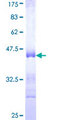 COL5A3 / Collagen V Alpha 3 Protein - 12.5% SDS-PAGE Stained with Coomassie Blue.