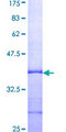 COL6A1 / Collagen VI Alpha 1 Protein - 12.5% SDS-PAGE Stained with Coomassie Blue.