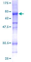 COL6A2 / Collagen VI Alpha 2 Protein - 12.5% SDS-PAGE of human COL6A2 stained with Coomassie Blue