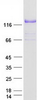 COL6A2 / Collagen VI Alpha 2 Protein - Purified recombinant protein COL6A2 was analyzed by SDS-PAGE gel and Coomassie Blue Staining
