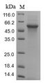 COL6A3 / Collagen VI Alpha 3 Protein - (Tris-Glycine gel) Discontinuous SDS-PAGE (reduced) with 5% enrichment gel and 15% separation gel.
