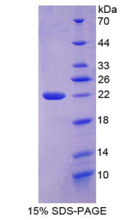 COL6A3 / Collagen VI Alpha 3 Protein - Recombinant Collagen Type VI Alpha 3 By SDS-PAGE