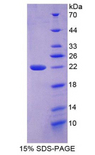 COL6A3 / Collagen VI Alpha 3 Protein - Recombinant Collagen Type VI Alpha 3 By SDS-PAGE