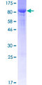 COL6A5 / Collagen VI Protein - 12.5% SDS-PAGE of human COL29A1 stained with Coomassie Blue