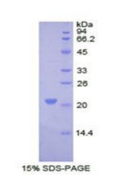 COL8A1 / Collagen VIII Alpha 1 Protein - Recombinant Collagen Type VIII Alpha 1 By SDS-PAGE