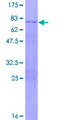 COL8A2 / Collagen VIII Protein - 12.5% SDS-PAGE of human COL8A2 stained with Coomassie Blue