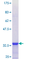 COL8A2 / Collagen VIII Protein - 12.5% SDS-PAGE Stained with Coomassie Blue.
