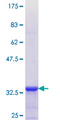 COL8A2 / Collagen VIII Protein - 12.5% SDS-PAGE Stained with Coomassie Blue.
