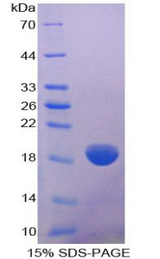 COL8A2 / Collagen VIII Protein - Recombinant Collagen Type VIII Alpha 2 By SDS-PAGE