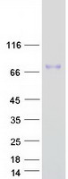 COL8A2 / Collagen VIII Protein - Purified recombinant protein COL8A2 was analyzed by SDS-PAGE gel and Coomassie Blue Staining