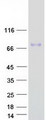 COL8A2 / Collagen VIII Protein - Purified recombinant protein COL8A2 was analyzed by SDS-PAGE gel and Coomassie Blue Staining