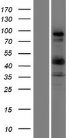COL9A1 / Collagen IX Protein - Western validation with an anti-DDK antibody * L: Control HEK293 lysate R: Over-expression lysate