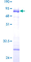COL9A1 / Collagen IX Protein - 12.5% SDS-PAGE of human COL9A1 stained with Coomassie Blue