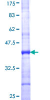 COL9A1 / Collagen IX Protein - 12.5% SDS-PAGE Stained with Coomassie Blue.