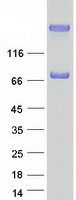 COL9A1 / Collagen IX Protein - Purified recombinant protein COL9A1 was analyzed by SDS-PAGE gel and Coomassie Blue Staining